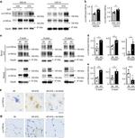 Phospho-p130Cas (Tyr410) Antibody in Immunohistochemistry (IHC)