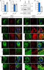 PDI Antibody in Immunocytochemistry (ICC/IF)