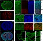 SOX2 Antibody in Immunohistochemistry (IHC)