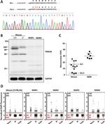 TNNI3K Antibody in Western Blot (WB)