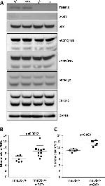 TNNI3K Antibody in Western Blot (WB)