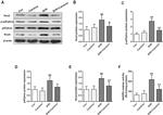 Phospho-p47phox (Ser370) Antibody in Western Blot (WB)