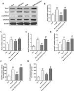 Phospho-p47phox (Ser370) Antibody in Western Blot (WB)