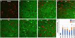 Alexa Fluor 488 Antibody in Immunohistochemistry (IHC)