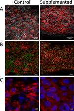 Cardiac Troponin T Antibody in Immunohistochemistry (IHC)