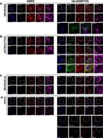 ATP Synthase beta Antibody in Immunocytochemistry (ICC/IF)