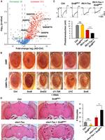 Tau Antibody in Immunoprecipitation (IP)