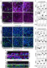 Cytokeratin 5 Antibody in Immunocytochemistry (ICC/IF)