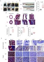 IL-11 Antibody in Immunohistochemistry (IHC)