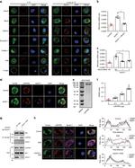 ARF6 Antibody in Immunocytochemistry (ICC/IF)