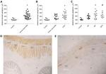 NSE Antibody in Immunohistochemistry (IHC)