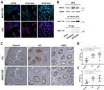 ST6GALNAC1 Antibody in Immunohistochemistry (IHC)