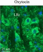 Oxytocin Antibody in Immunohistochemistry (IHC)