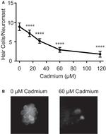 Parvalbumin Antibody in Immunohistochemistry (IHC)