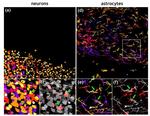 GFAP Antibody in Immunohistochemistry (IHC)