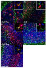 GFAP Antibody in Immunohistochemistry (IHC)