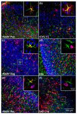 GFAP Antibody in Immunohistochemistry (IHC)