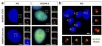 Ninein Antibody in Immunocytochemistry (ICC/IF)