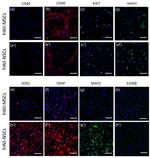 GFAP Antibody in Immunocytochemistry (ICC/IF)