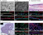 MUC5AC Antibody in Immunohistochemistry (IHC)