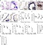 Acetyl-alpha Tubulin (Lys40) Antibody in Immunohistochemistry (IHC)