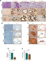 MUC5AC Antibody in Immunohistochemistry, Immunohistochemistry (Paraffin) (IHC, IHC (P))