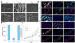 Vimentin Antibody in Immunohistochemistry (IHC)