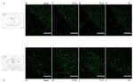 beta Amyloid Antibody in Immunohistochemistry (IHC)