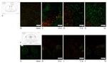 beta Amyloid Antibody in Immunocytochemistry, Immunohistochemistry (ICC/IF, IHC)