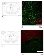 beta Amyloid Antibody in Immunocytochemistry, Immunohistochemistry (ICC/IF, IHC)