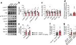 GLUT4 Antibody in Western Blot (WB)