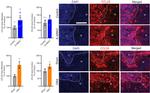 TECK Antibody in Immunohistochemistry (IHC)