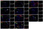 KLF4 Antibody in Immunocytochemistry (ICC/IF)