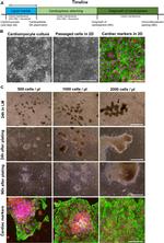 Cardiac Troponin T Antibody in Immunocytochemistry (ICC/IF)