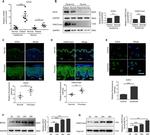 EZH2 Antibody in Immunohistochemistry (IHC)