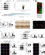 EZH2 Antibody in Immunocytochemistry (ICC/IF)