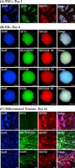 Nestin Antibody in Immunocytochemistry (ICC/IF)