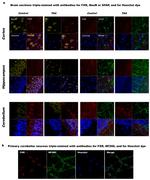 FXR Antibody in Immunocytochemistry (ICC/IF)