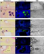 Staphylococcus aureus Antibody in Immunohistochemistry (IHC)