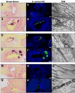 Staphylococcus aureus Antibody in Immunohistochemistry (IHC)