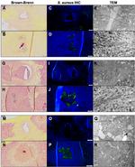 Staphylococcus aureus Antibody in Immunohistochemistry (IHC)