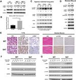 Phospho-p70 S6 Kinase (Thr421) Antibody in Immunohistochemistry (IHC)