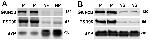 DAPK1 Antibody in Western Blot (WB)