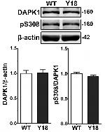 DAPK1 Antibody in Western Blot (WB)