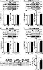 DAPK1 Antibody in Western Blot (WB)