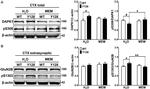 DAPK1 Antibody in Western Blot (WB)