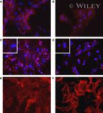 ZO-1 Antibody in Immunohistochemistry (IHC)