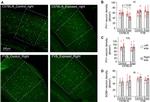 Parvalbumin Antibody in Immunohistochemistry (IHC)