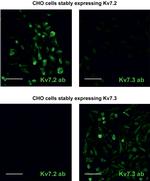 KCNQ2 Antibody in Immunocytochemistry, Immunohistochemistry (ICC/IF, IHC)