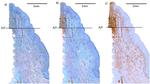 CD20 Antibody in Immunohistochemistry (IHC)